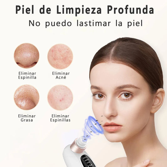 Aspirador Facial de Cravos – Succión USB y 5 Niveles de Potencia