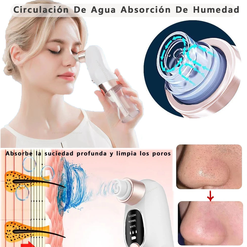 Aspirador Facial de Cravos – Succión USB y 5 Niveles de Potencia