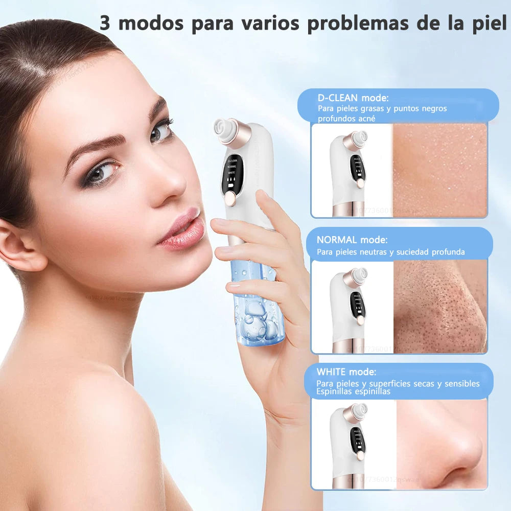 Aspirador Facial de Cravos – Succión USB y 5 Niveles de Potencia
